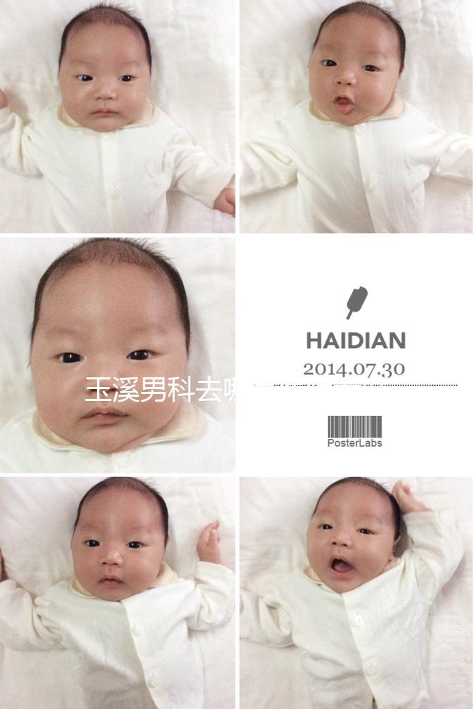 玉溪男科去哪家醫(yī)院看好，怎么選攻略，這個(gè)排行榜不要錯(cuò)過(guò)