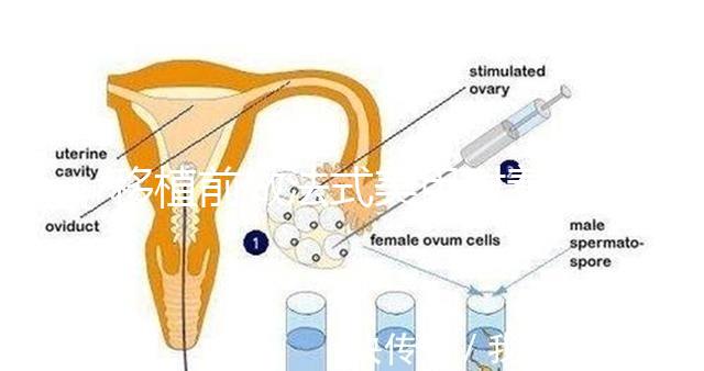 移植前做法式美甲對(duì)著床影響不少，別以為貼甲片就沒事了