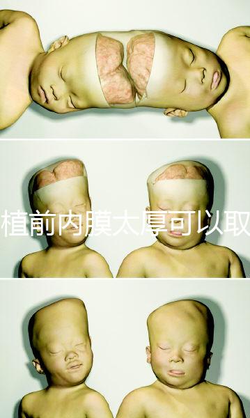 移植前內膜太厚可以取卵早知道，疼痛因人而異