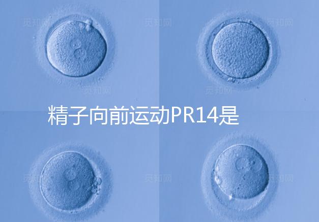 精子向前運(yùn)動PR14是否正常聽專家怎么說，當(dāng)心弱精找上門
