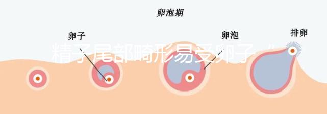 精子尾部畸形易受卵子“嫌棄”，無尾、短卷尾需重視