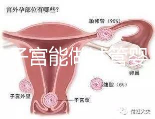 雙角子宮能做試管嬰兒嗎？可以，但這2大條件缺一不可