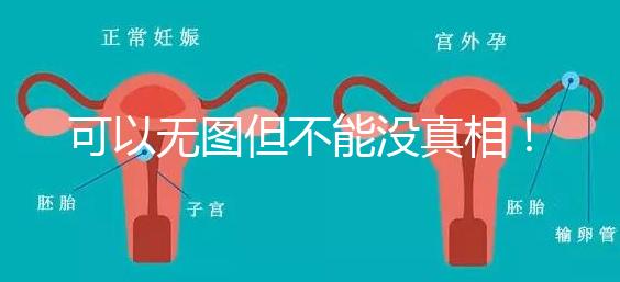 可以無圖但不能沒真相!段濤大夫帶你了解B超檢查報告單