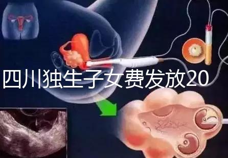 四川獨生子女費發(fā)放2024年新規(guī)定,如何盡快領(lǐng)取自貢?