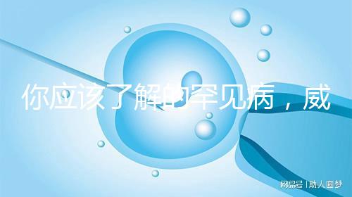 你應(yīng)該了解的罕見病,威廉姆斯綜合癥