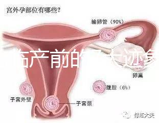 二胎臨產(chǎn)前的7大跡象，出現(xiàn)見紅、陣痛別大意
