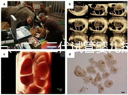 一、二、三代試管嬰兒技術的區別，看完你就知道了！