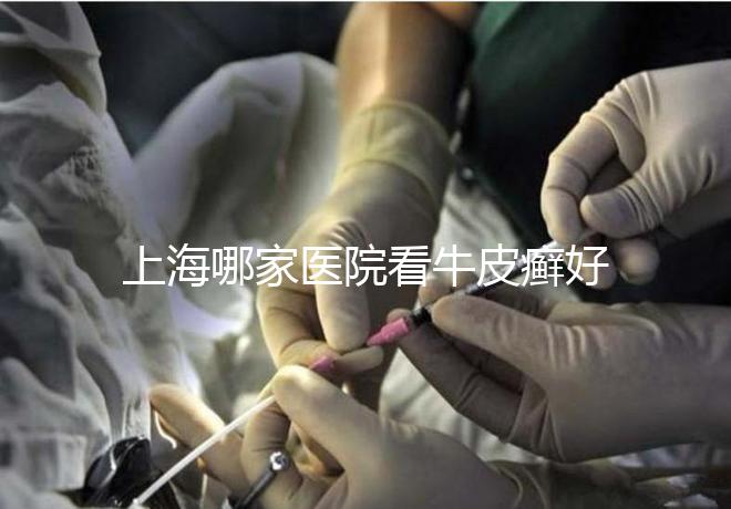 上海哪家醫(yī)院看牛皮癬好（上海治銀屑病最好的醫(yī)院）