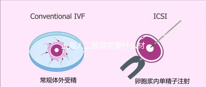 上海人工授精需要什么材料和手續(xù)戳，提前做好準(zhǔn)備很重要