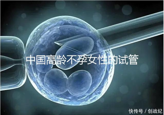 中國高齡不孕女性的試管嬰兒指南，8個方面5條推薦意見