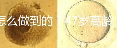怎么做到的？47歲高齡試管嬰兒唯一男胚一次移植成功！