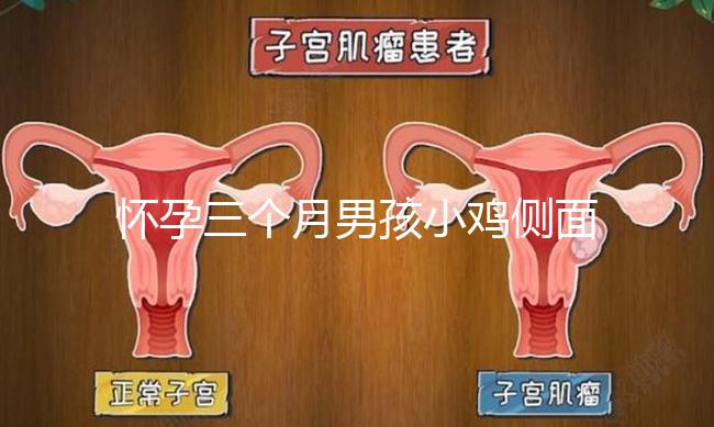 懷孕三個月男孩小雞側面二維b超圖片分享，原來兩腿間有尖