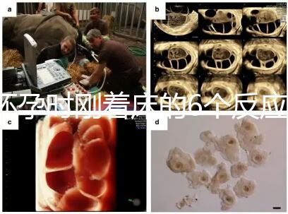 懷孕時剛著床的6個反應(yīng),同房后這個時候觀察身體最準(zhǔn)