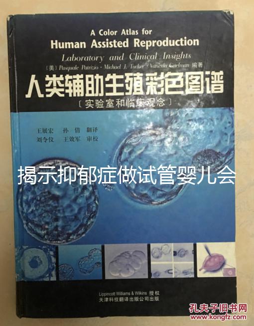 揭示抑郁癥做試管嬰兒會遺傳給女兒，想避免看這個