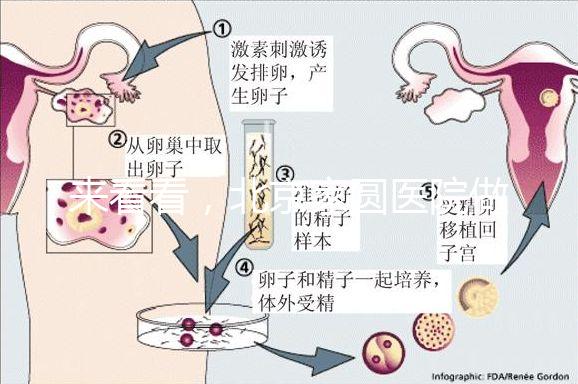 來看看，北京家圓醫院做三代試管費用總共多少？