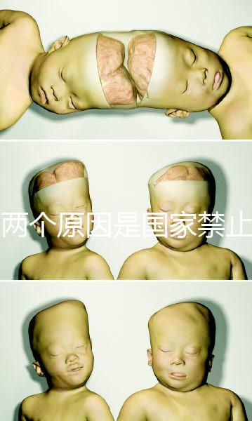 有兩個(gè)原因是國家禁止中非混血中國會(huì)接受嗎？