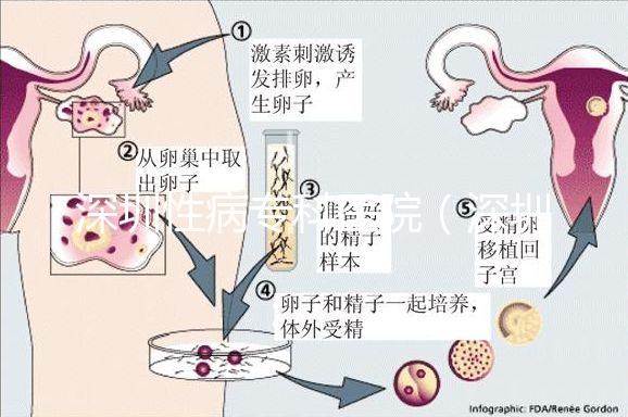 深圳性病?？漆t院（深圳hpv病毒治療中心）