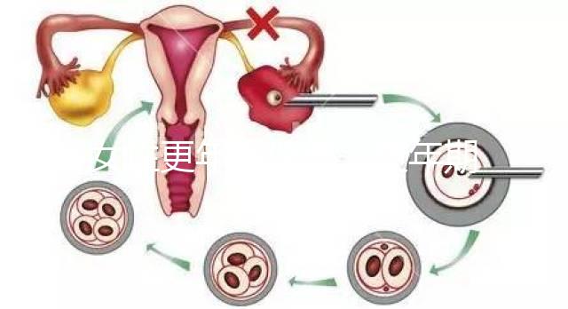 女性更年期保?。ǜ昶趮D女保健健康宣教）