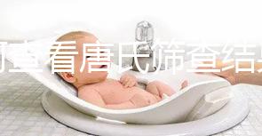 如何查看唐氏篩查結(jié)果，珠海醫(yī)院價格二百四起