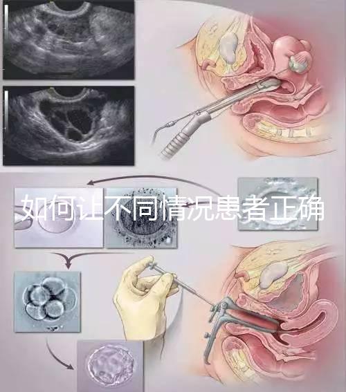 如何讓不同情況患者正確進行人工授精,看看相因醫(yī)生怎么說