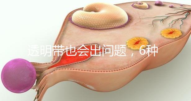 透明帶也會出問題，6種異常類型形成原因不同