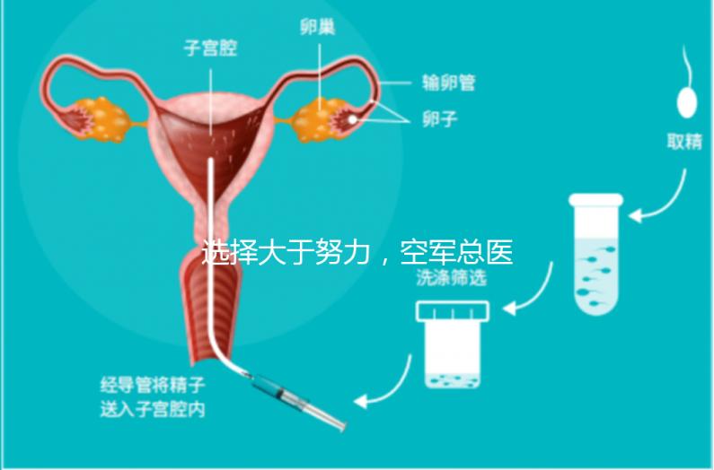 選擇大于努力，空軍總醫(yī)院做試管嬰兒必讀攻略