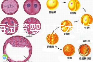 青海試管嬰兒技術(shù)助孕二胎 2家醫(yī)院費用
