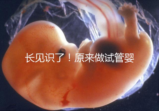 長見識了！原來做試管嬰兒，精子是這樣被篩選出來的