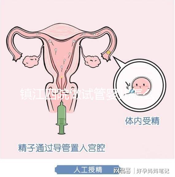 鎮(zhèn)江四院做試管嬰兒怎么樣？具體成功率費用介紹