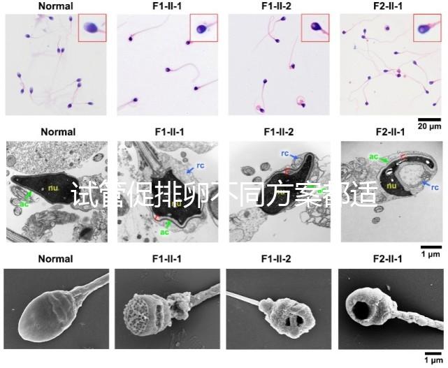 試管促排卵不同方案都適合哪些人？如何監(jiān)測排卵？