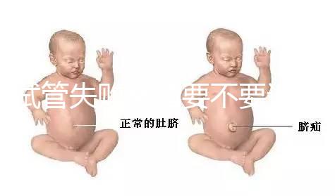 試管失敗離婚要不要退彩禮揭秘,三金怎么處理?