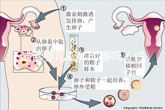 試管嬰兒取卵時(shí)疼嗎(試管嬰兒取卵時(shí)疼嗎,取卵多長(zhǎng)時(shí)間才是移植)
