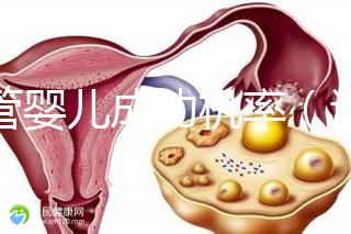 試管嬰兒成功機率（試管嬰兒成功機率有多少）