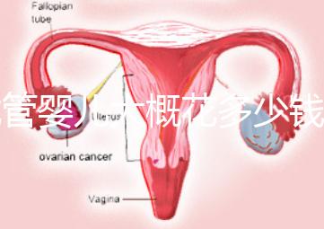 試管嬰兒大概花多少錢（試管嬰兒大概花多少錢費用）