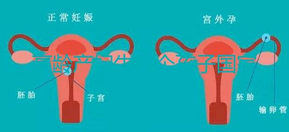 高齡產(chǎn)婦生八個孩子國家有補(bǔ)助？有沒有違法才是關(guān)鍵