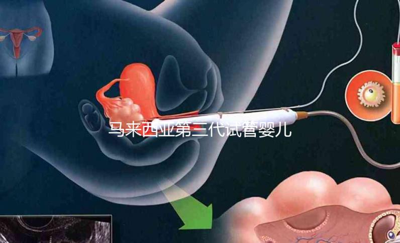 馬來西亞第三代試管嬰兒費(fèi)用真不貴,8萬起無額外收費(fèi)
