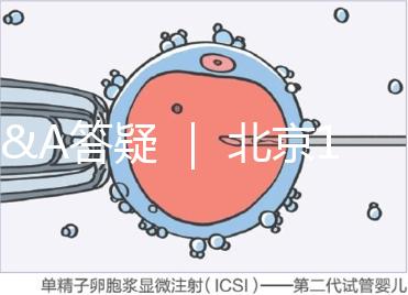 Q&A答疑 ｜ 北京16項輔助生殖技術進醫保，試管可以報銷嗎？