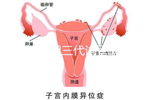 2025昆明三代試管助孕費(fèi)用一覽,8-15萬元,價(jià)格透明公開自主選擇