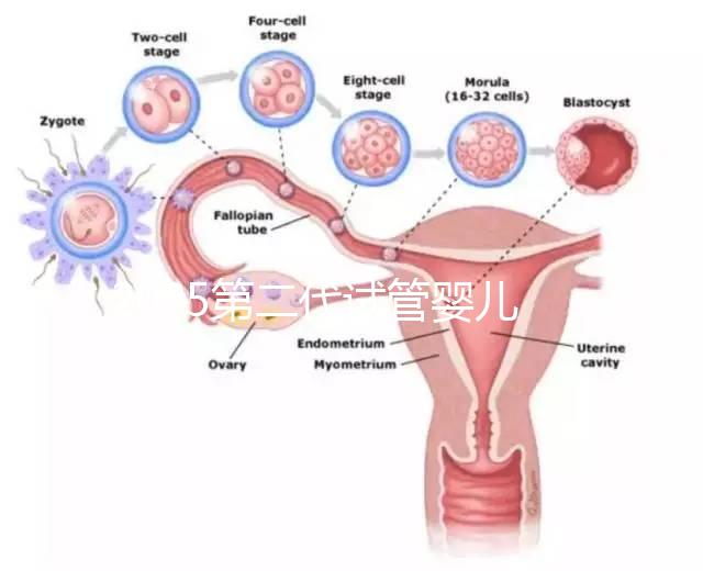2025第二代試管嬰兒全流程解析：從檢查到移植各階段費(fèi)用數(shù)據(jù)揭秘