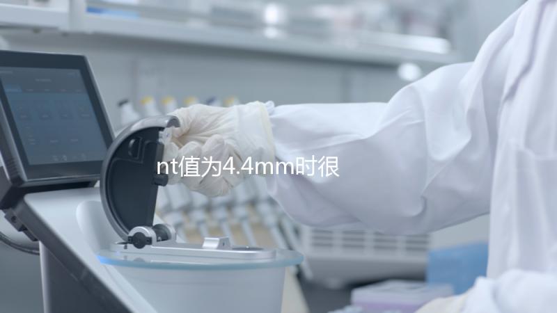 nt值為4.4mm時很危險，及時羊穿確認(rèn)胎兒畸形很重要